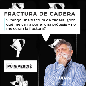 en una fractura de cadera cuándo se pone una prótesis por el Dr Lluís