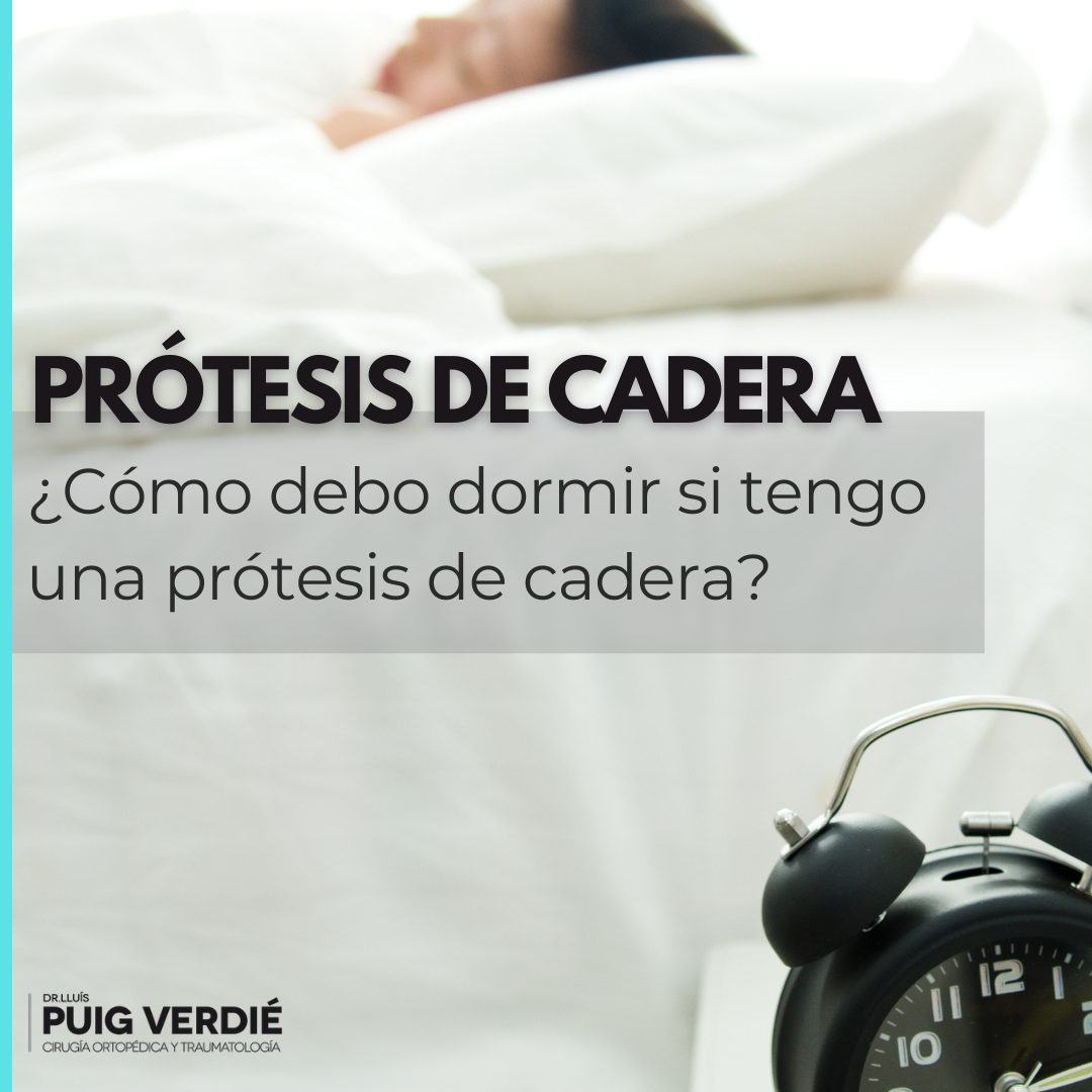 cómo-debo-dormir-si-tengo-una-prótesis-de-cadera - lluispuigverdie.es