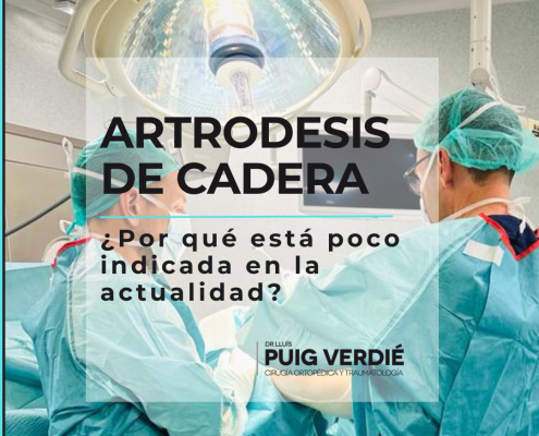 artrodesis de cadera por el Dr. Lluís Puig Verdié