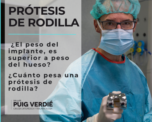 cúal es el peso de una prótesis de rodilla por el Dr. Lluís Puig Verdié cirujano experto en cirugía de prótesis de rodilla y cadera en Barcelona