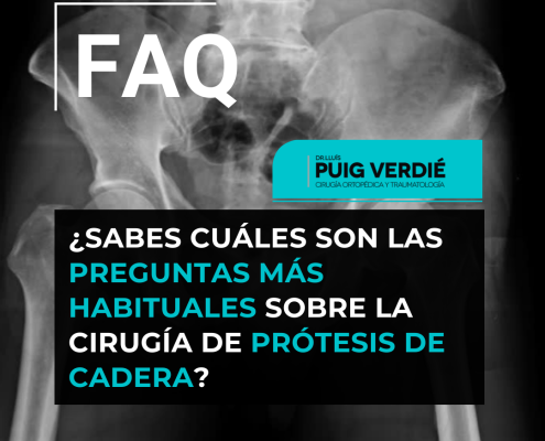 Preguntas frecuentes sobre la cirugía de prótesis de cadera por el Dr. Lluís Puig Verdié traumatólogo experto